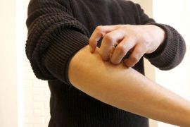 Brote epidemiológico