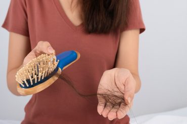 Caida de pelo